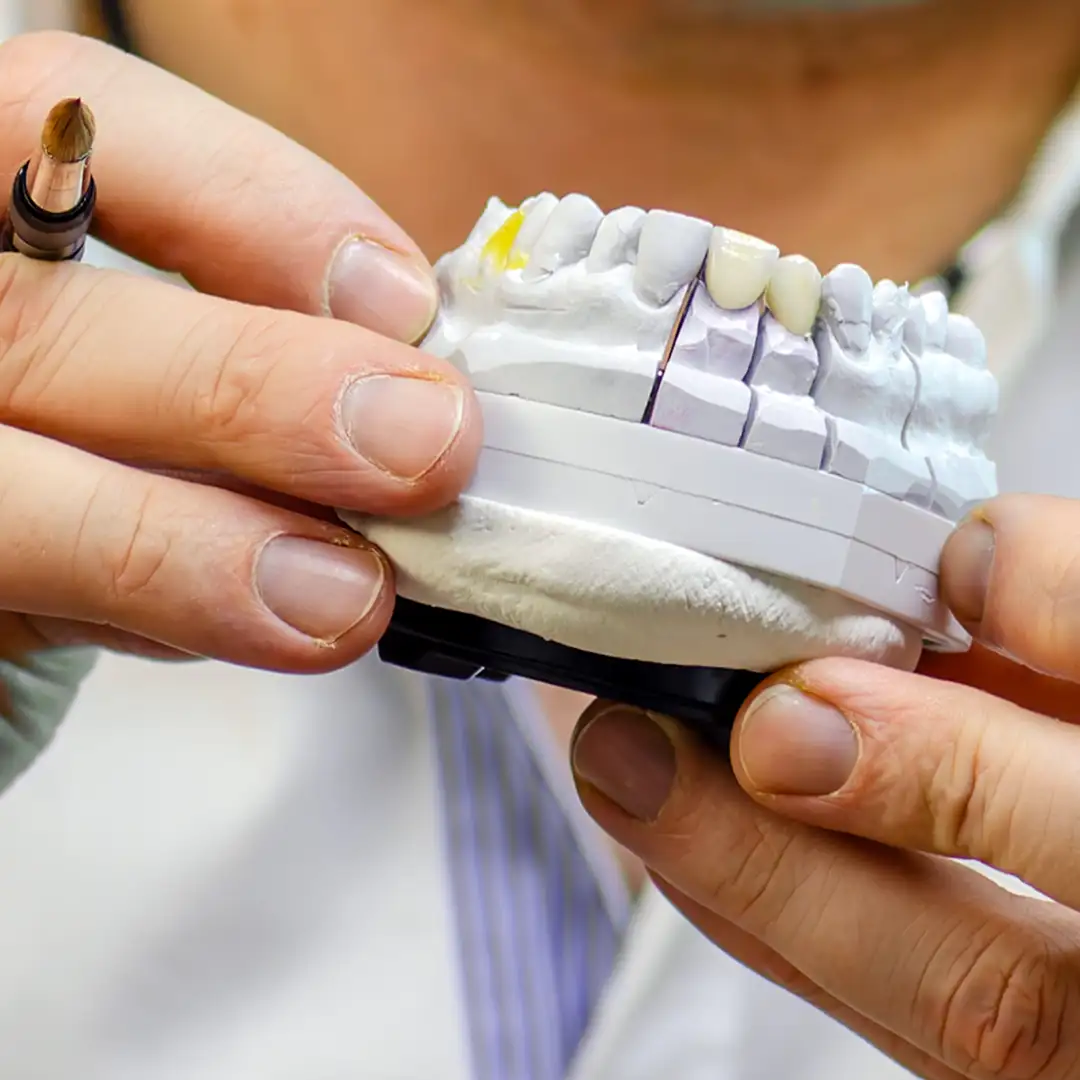 Detailansicht der Hände von Kes Carpenter mit feinem Pinsel bei der filigranen Ausarbeitung von Vollkeramik-Zahnersatz auf einem Kiefermodell.